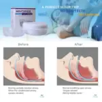 Anti-Snoring Aid Device